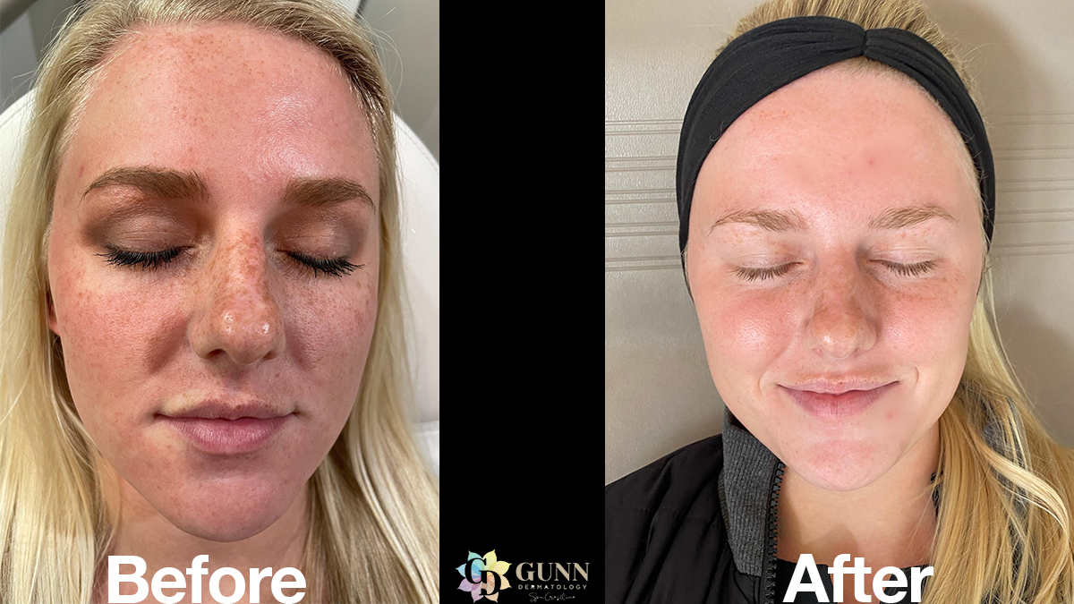 60b80d1376d0325a3ba377e2_Untitled-1